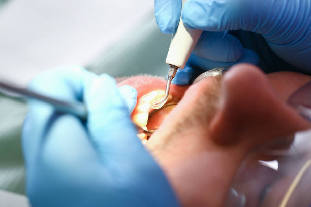 Best Pediatric Emergency Dentist in St James, NY